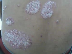 ţƤѢ���ּ���������Ӧ����ô��������