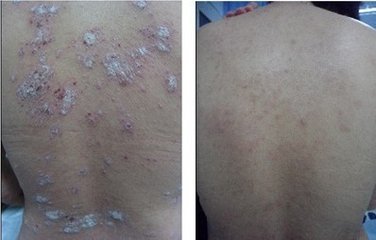 ţƤѢ�ں�תʱ����֢״��ʲô